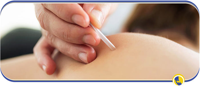 Trigger Point Injections Specialist Near Me in San Ramon, CA