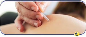 Trigger Point Injections Specialist Near Me in San Ramon, CA