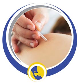 Trigger Point Injections Treatment Near Me in San Ramon, CA