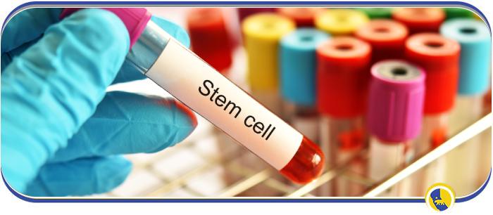 Stem Cell Therapy Cost in San Ramon CA Stem Cell Therapy Cost in San Ramon CA
